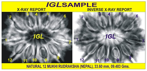 X-ray and inverse X-ray report of a natural 12 Mukhi Nepali Rudraksha
